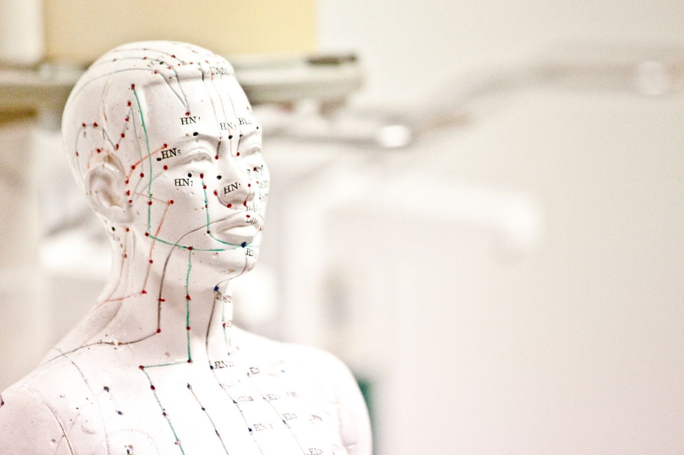 Acupuncture